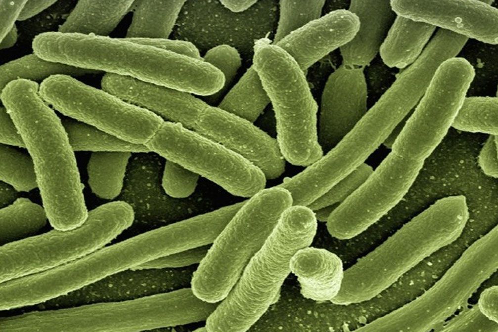 Escheria Koli Bakterien